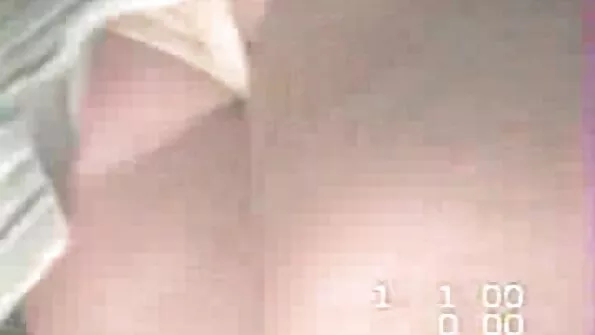 Plaukuota gakta ir skurdus šipulė nėra problema, kai yra analinis.